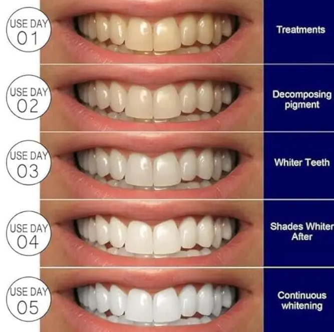 Teeth Whitening Strips Kit | Portable Dental Whitening Strips | Reduced Sensitivity White Strips for Home Use